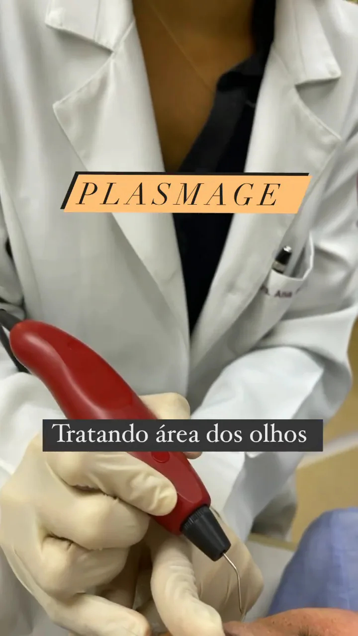 Plasmage na área dos olhos