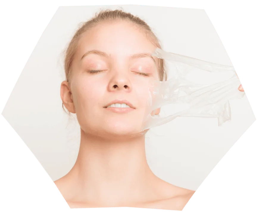 Peelings químicos — tratamento com a Dra. Ana Elisa Brito Vilibor, dermatologista