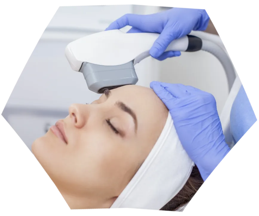 Ultraformer MPT — tratamento com a Dra. Ana Elisa Brito Vilibor, dermatologista